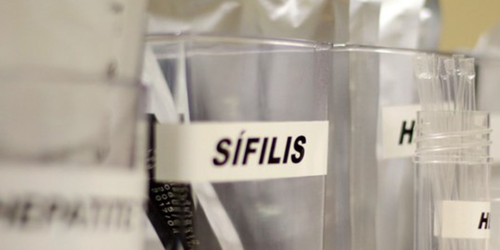 Testagem grátis de HIV, hepatite, síflis e gonorreia